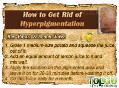 item-thumbnail Get Rid Of Hyperpigmentation, Age Spots On Face, Top 10 Home Remedies, Raw Potato, Acne Dark Spots, Reduce Hyperpigmentation, Lighten Skin, Skin Cream, Simple Skincare