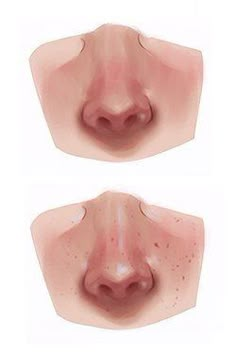 three different angles of the nose and mouth