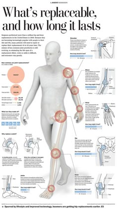 Graphic for the Health section describing which and how joints are replaced as well as their estimated duration. Illustrator, Lightwave 3d and Photoshop. Knee Replacement, Med Student, Medical Information, Anatomy And Physiology, The Human Body, Human Anatomy, Massage Therapy, Physical Therapy