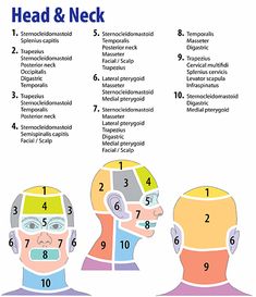 Headache Chart, Pressure Points For Headaches, Relieve Sinus Pressure, Eye Pain, Sinus Pressure, Trigger Point Therapy, Oil Remedies, Migraine Headaches, Trigger Points