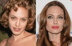 Angelina Jolie Nose Job, Angelina Jolie Nose, Angelina Jolie Plastic Surgery, Rhinoplasty Surgery