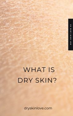 You may experience dry skin during the cold, dry winter months. Dry skin is uncomfortable - it is overly tight, dehydrated, rough, and may flake and itch. Oil Cleansing, Milk Cleanser, Wild Orange, Oil Cleanser, Orange Oil, Cleansing Oil, Winter Months, Healthy Skin