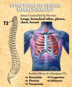 T3 Emt Study, Body Alignment