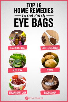 Top 16 Home Remedies To Get Rid Of Eye Bags Eyes Bags Remedy, Undereye Bags Remedy Get Rid Of, Eyebags Remedy Under Eyes, How To Get Rid Of Eye Bags Fast, Eye Bags Remedy, Undereye Bags Remedy, Get Rid Of Eye Bags, Rid Of Eye Bags, Eye Bag Remedies