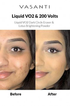 Eye Concealer For Dark Circles, Concealer Under Eye, Dark Spots Under Eyes, Colour Corrector, Brightening Powder, Corrector Concealer, Concealer For Dark Circles, Dark Under Eye