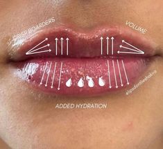 Armonizacion Facial, Lip Fillers Juvederm, Filler Lip, Lip Permanent Makeup, Lips Inspiration, Skin And Hair Clinic