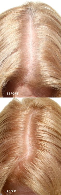 Hair Colour Shades, Best Hair Colour, Grey White Hair, Hair 101, Colour Remover, At Home Hair Color, Colour Shades, Light Blonde Hair, How To Lighten Hair