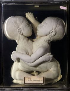 there is a statue of two babies hugging each other