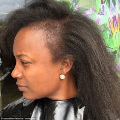 Atlanta hairstylist shares videos of clients suffering from hair loss due to weaves Damaged Black Hair, Tan Skin Blonde Hair, Hair Issues, African American Hairstyles