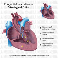 the anatomy of the heart, labeled in three different ways and labeled with corresponding labels