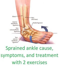 Sprained ankle cause, symptoms, and treatment with 2 exercises2 Ankle Rehab Exercises, Ankle Pain Relief, Ankle Stability, Ankle Sprain, Back Pain Remedies