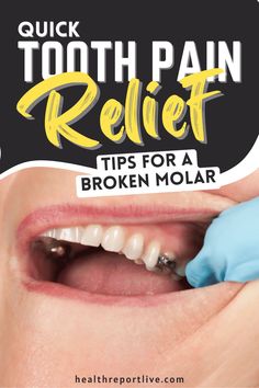 Quick Tooth Pain Relief Tips for a Broken Molar Impacted Tooth, Molar Tooth