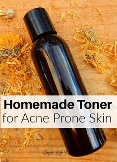 Homemade Toner for Acne Prone Skin - a DIY toner. Discover the step-by-step journey towards creating a natural, skin-loving solution that could be your key to battling stubborn acne. Empower yourself with knowledge and bid farewell to irritating breakouts. Beware, clear skin ahead! Cleansing Essential Oils, Toner For Acne Prone Skin, Traditional Homemaking, Aloe Tea, Homemade Toner, Tea Tree Toner, Diy Toner, Homestead Blog, Soap Business