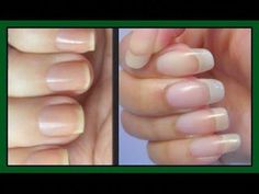 In this video, I shared my personal nail treatment for growing nails stronger and longer in just seven days.DONT FORGET TO  SHARE WITH YOUR FRIENDS AND FAMIL... Unpolished Nails, Nut Board, Khichi Beauty, Arti Thali, Grow Long Nails, Longer Nails, Nail Growth Tips