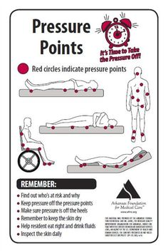 a sign with instructions on how to use the pressure point for an injured person's foot