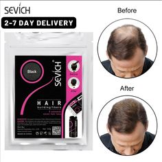 Natural Keratin Hair Building Fiber Refill Bag Hair Loss Balding hair regrowth 200g PRODUCT DESCRIPTION 1. The Product has no Sense of Weight and Discomfort, such as no Harm to the Eyes and Mouth; 2, Do not fall off, Do not fade, such as Fell to the Clothes, Gently Knocked to drop; 3, No Harm to the Scalp, hair, can be used at ease; Face Hair Removal, Hair Care Growth, Hair Powder, Bald Hair, Hair Extentions, Hair Brush Straightener, Eye Makeup Brushes, Keratin Hair, Hair Thickening