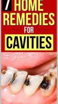 Cavity Remedy Diy, Baby Teeth Chart, Teeth Whitner, Cavity Remedy, Home Remedies For Cavities, Teeth Yellow, Teeth Chart