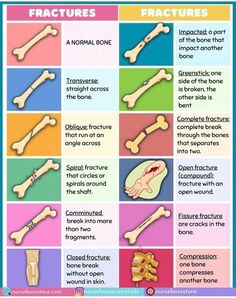 different types of bones and their functions in the human body, including bone structure and function