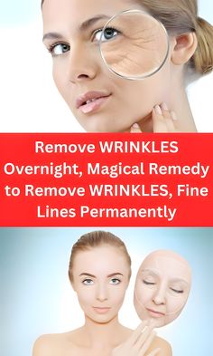 The Wrinkle-Removing Hack That Works Like Magic >>CHECK IT OUT<< Wrinkles Remedies Face, Dark Spots Remedies, Wrinkle Remedies, Anti Aging Skincare Routine, Wrinkle Free Skin, Face Wrinkles, Skin Care Steps, Effective Skin Care Products, Going Viral