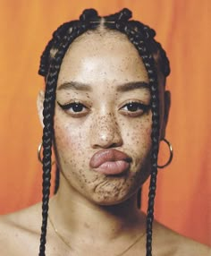 a woman with freckles on her face and nose