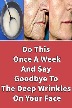 Wrinkles Remedies Face, Obličejové Masky, Mouth Wrinkles, Wrinkle Remedies, Wrinkle Free Skin, Face Wrinkles, Wrinkled Skin, Skin Remedies