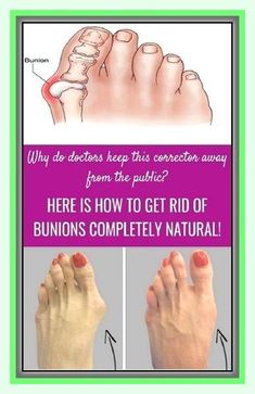 Terrific  tips! Healthy Beauty, Simple Recipe, Guided Meditation, Wellness Tips, Health Issues, Health Remedies, Natural Health, Pain Relief, Home Remedies