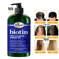 BEST SHAMPOO FOR THIN HAIR - Deeply Cleanses hair while promoting healthy hair growth. NATURAL HAIR LOSS SHAMPOO - Fortified, strengthening formula with Biotin, a water-soluble vitamin that's a part of the vitamin B family. Your body needs biotin to help convert certain nutrients into energy. BEST HAIR GROWTH SHAMPOO - Biotin plays an important role in the health of your hair, skin, and nails. A lack of Biotin can lead to hair loss.ttex... IDEAL SHAMPOO FOR THINNING HAIR AND HAIR LOSS MEN OR WOMEN - Strengthening formula leaves hair stronger, fuller and thicker while encouraging healthy hair growth. BEST HAIR THICKENING SHAMPOO: Our Pro-Growth Biotin Shampoo is sulfate free, paraben free, phtalate free. It works to keep your hair color vibrant while giving your hair manageability, softness Best Hair Growth Shampoo, Best Hair Thickening Shampoo, Best Shampoo For Women, Hair Color Vibrant, Hair Growth Natural Hair, Hair Thickening Shampoo, Best Hair Growth, Biotin Shampoo, Shampoo For Thinning Hair