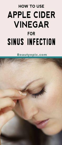 6 Most Effective Ways to Use Apple Cider Vinegar to Treat Sinus Infection Treating Sinus Infection, Doctor Advice, Healthy Diet Tips, Sinus Infection, Daily Health Tips, Fitness Advice, Good Health Tips, Lose 40 Pounds, Health And Fitness Tips