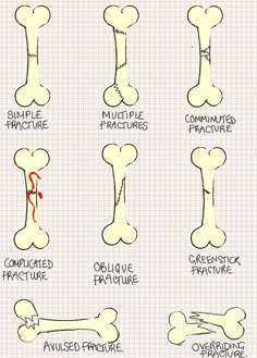 an image of bone structure chart with different bones and their corresponding parts to each bone