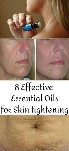 Skin Tightening Essential Oil, For Skin Tightening, Essential Oils Health, Essential Oils For Skin, Saggy Skin, Skin Aging, Skin Care Recipes