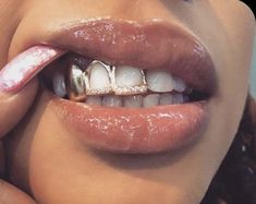 Mouth Grills, Girl Grillz, Pretty Teeth, Grillz Teeth, Dental Impressions, Diamond Teeth, Dope Jewelry Accessories, Grills Teeth, Tooth Gem