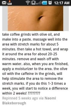 Baking Soda Shampoo, Stretch Mark, Beauty Remedies, Beauty Tricks, Beauty Skin Care Routine, Diy Skin, Health And Beauty Tips, Skin Tips, Beauty Treatments