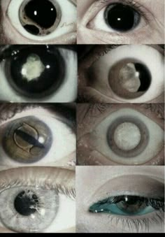 several different types of eyes with the same amount of contact between them and one that appears to be an eyeball