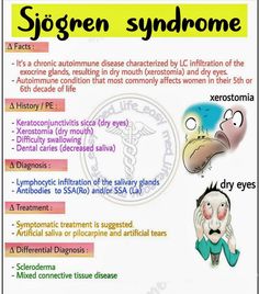 Exocrine Gland, General Medicine, Medical Notes, Sjogrens Syndrome, Pa School, Medical School Essentials, Med School, Nurse Practitioner, Dry Eyes