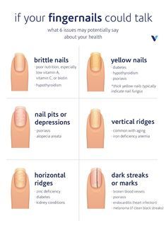 Fingernail Health, Health Signs, Brittle Nails, Nail Growth, Nail Health, Manicure Y Pedicure, Healthy Nails, Trendy Baby