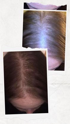 Blond Ideas, Looks For Short Hair, How To Regrow Hair, Brunette Ideas, Grow Hair Back, Get Shiny Hair, Monat Rejuveniqe Oil, Braids Short Hair, Cheap Shampoo