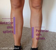 the legs and ankles of a woman with shin splints are shown in this graphic