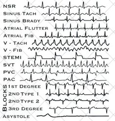 Ekg Technician Aesthetic, Ekg Interpretation Made Easy, Ekg Tech, Cardiac Health, Ekg Technician, Er Tech, Medical Assistant Student, Paramedic School, Prostate Health Men