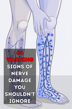 Lack of vitamin B12 could impact nerve health by hindering the body's ability to produce myelin, a protective covering for nerves. #NerveHealth #B12Deficiency #NerveFunction Nerve Health, Dry Bones, Hunting Decor, Short Shag, Sciatic Nerve Pain, Health Ideas, Nerve Damage, Nerve Cell, Leg Pain