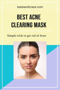 Acne is a totally common skin millstone and can depart following dark spots, marks, and scars. Acne is best treated subsequent to an overnight treatment and you profit a lot of down-acne night masks, serums, creams, etc. And they utterly are pricey. Acne Lotion, Acne Clearing, Organic Aloe Vera Gel, Living Better, Get Rid Of Acne, Rid Of Acne, Night Mask, Beauty Tips For Hair, How To Get Rid Of Acne