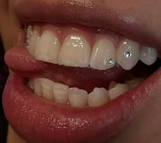 a woman's smile with braces and diamonds on the bottom part of her teeth