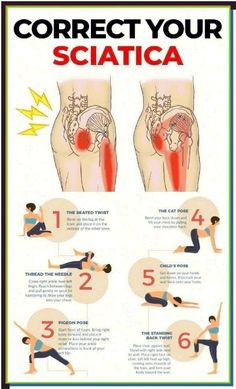 a poster explaining how to correct your sciatica