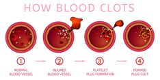 Facts Infographic, Medical Infographic, Blood Clotting, Drawing Blood, Infographic Illustration, Nitric Oxide, Vitamin K, Medical Devices, Medical Device