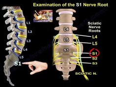 Spinal Nerves Anatomy, Nerve Anatomy, Sciatic Nerve Pain Relief, Spinal Surgery, Spinal Nerve, Lower Back Pain Exercises, Foot Pain Relief, Nerve Pain Relief