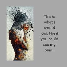 Chronic Migraines, Chronic Fatigue, Migraine, Chronic Illness, Chronic Pain, The Words, A Woman, Quotes