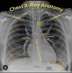 chest x - ray anatomy with words written all over it