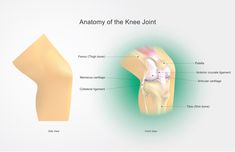 WEAK VMO & KNEE PAIN: How To Improve VMO Strength & Reduce Knee Pain In 5 Simple Steps Sore Knees, Human Legs, Leg Bones, Human Bones