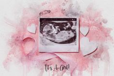 "✓ Watercolor Portrait   ✓ Ultrasound Sign✓ Watercolor Sonogram   Capture the beauty of your baby from the moment when he/she is still a bump with a personalized wall art. This custom baby portrait features the ultrasound photo of your own little angel and comes customized with a watercolor effect in the color of your choice. The Watercolor sonogram can be personalized for a boy, girl, or a gender-neutral choice. Make this sign part of your gender reveal and use it as a prop for the big reveal, Ultrasound Art, Baby Ultrasound, Pregnancy Art, Hospital Pictures, Baby Scan, Big Reveal, Shower Sign, Baby Portraits, Watercolor Portrait