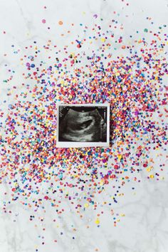 an x - ray image is surrounded by confetti and sprinkles