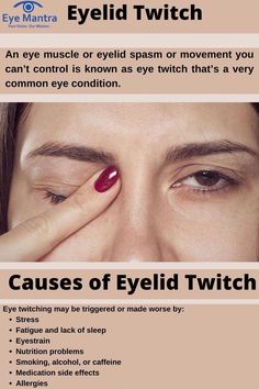 An eye muscle or eyelid spasm or movement you can’t control is known as eye twitch that’s very common eye condition. It is a repetitive.... Stop Eye Twitching, Eye Twitch, Eye Stye Remedies, Eye Twitching, Muscle Twitching, Holistic Health Remedies, Coconut Health Benefits, Feminine Health, Muscle Spasms